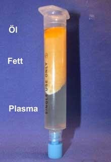 LIPOFILLING - Dott. Massimiliano Tripoli